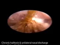 EVR Grass Seed Cat rostral rhinoscopy